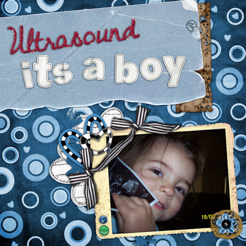 Ultrasound